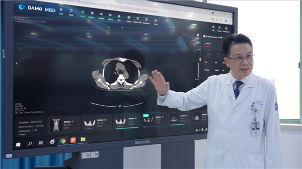 阿里巴巴发布全球首个胃癌影像筛查AI模型：CT就能识别早期胃癌