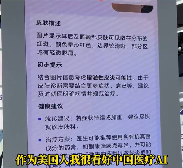 博主坦言美国看病太贵太麻烦：想把中国的AI医生带回去