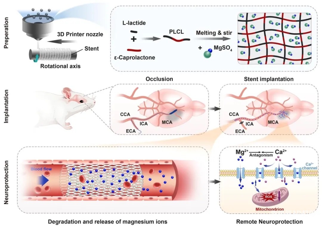3D打印镁离子序贯释放支架，具有神经保护功效
