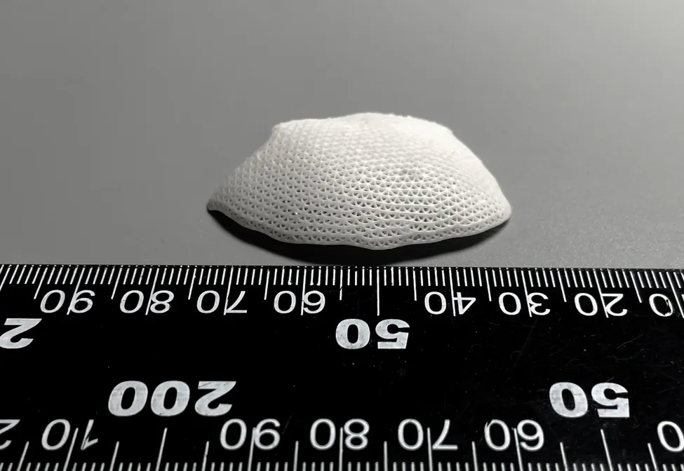 打印案例：DLP光固化陶瓷3D打印羟基磷灰石人体颅骨修复体