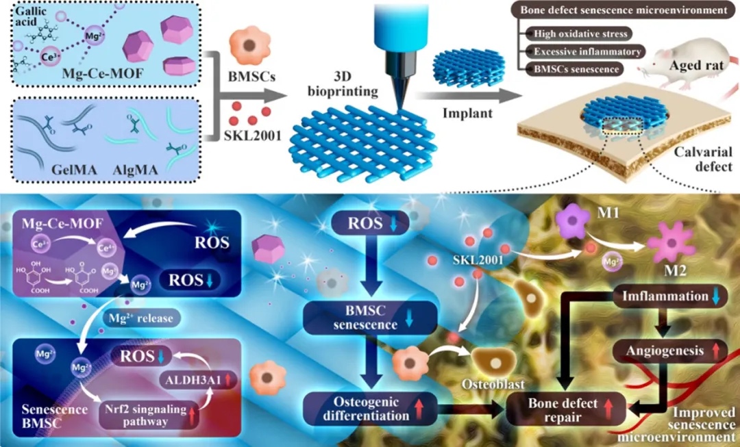 负载Mg-Ce-MOF的生物3D打印支架改善衰老微环境，促进老年骨缺损修复