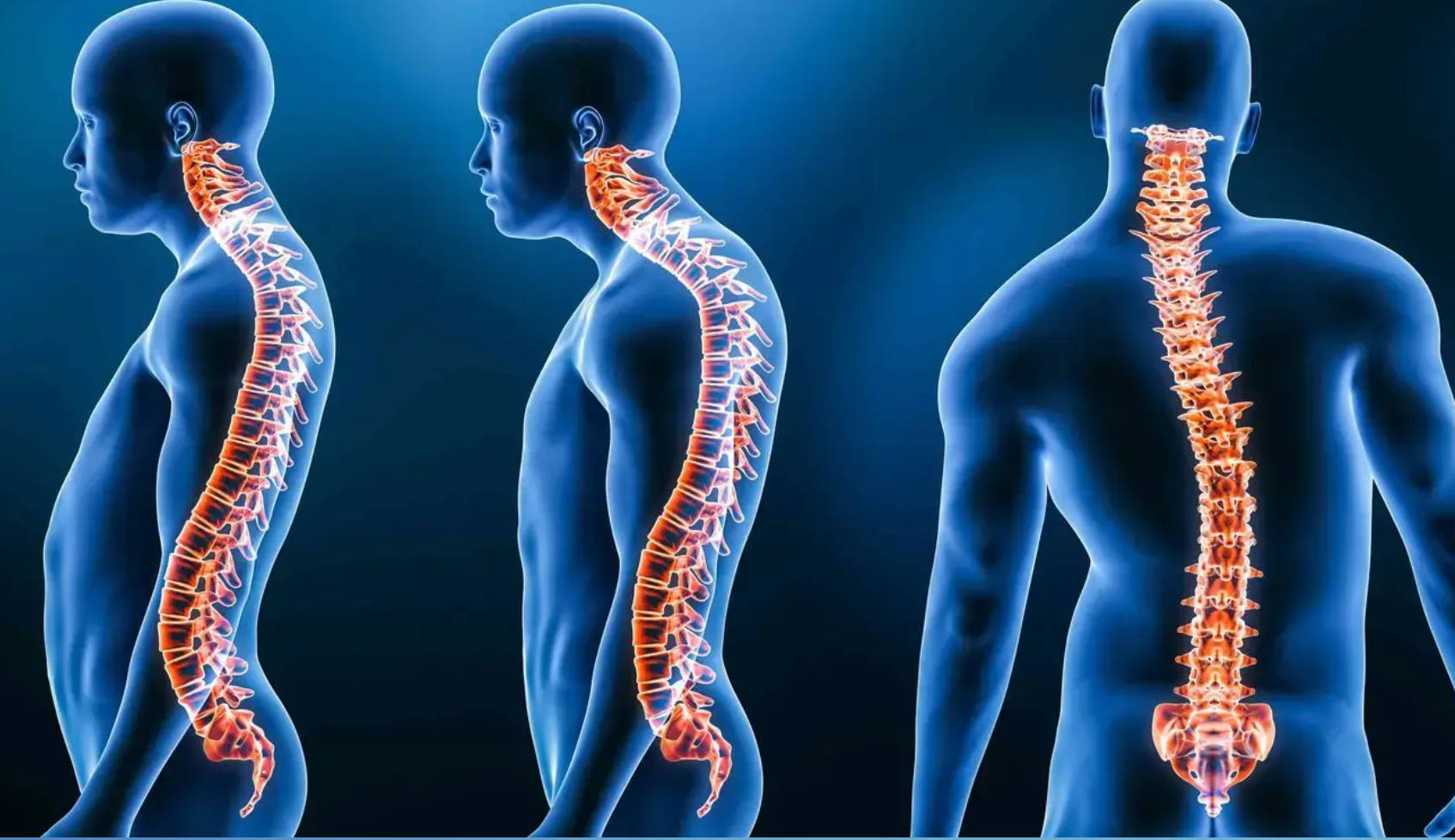 Nivalon研发无金属全陶瓷脊柱植入物，3D打印实现患者定制