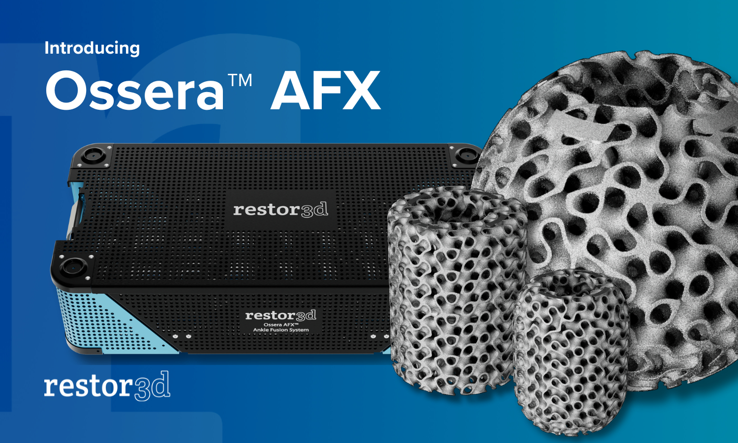restor3d推出Ossera AFX：针对复杂骨缺损的个性化3D打印植入物