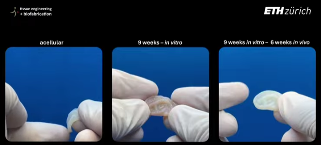 苏黎世联邦理工学院利用3D打印制造出性能接近天然组织的耳软骨