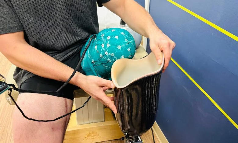 性能提升1600%！加拿大研究人员利用嵌入式压力传感器+AI算法打印假肢接受腔