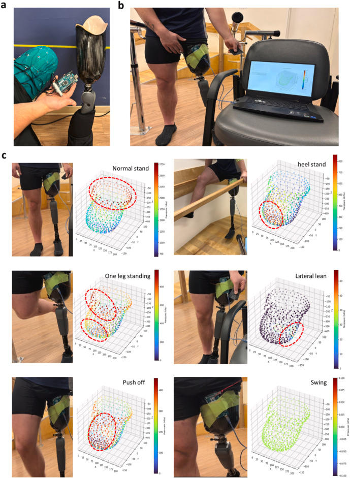 对截肢患者进行测试实施压力测试