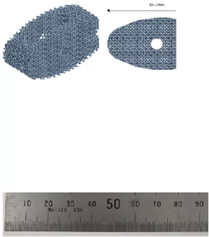 3D打印新型Ti-24Nb-4Zr-8Sn低模量多孔椎间融合器有望提高脊柱手术疗效