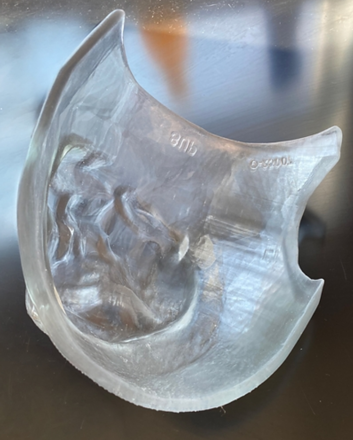 Myrava凭借获批（FDA）的3D打印剂量补偿器进军放射治疗领域
