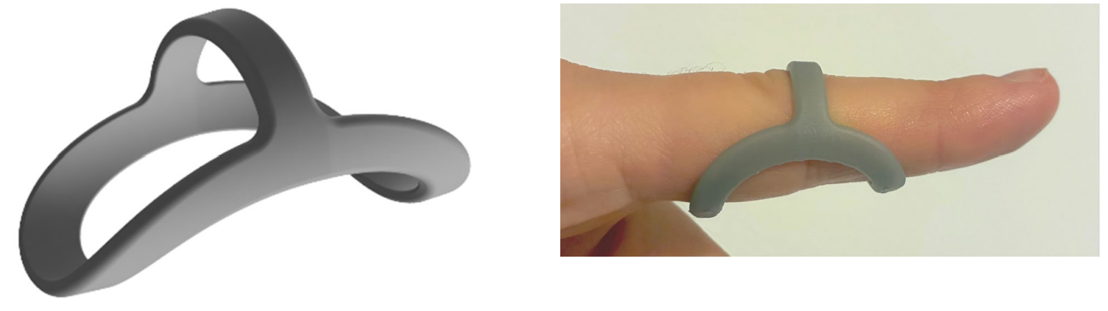 加拿大团队对比3D打印与热成型手指矫形器，3D打印方案获更高评价