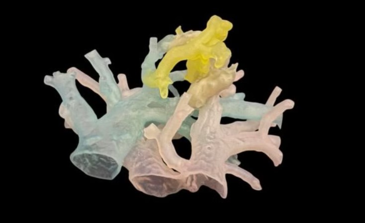 3D打印肺血管模型
